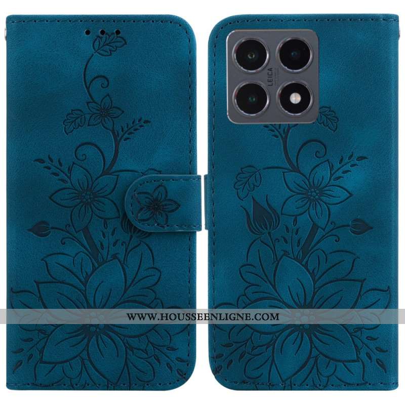 Housse Xiaomi 15T Lys